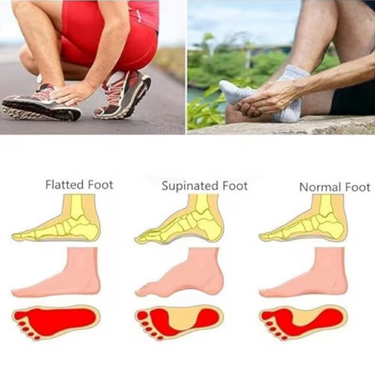 Arch Support Brace Pair with Compression Cushion