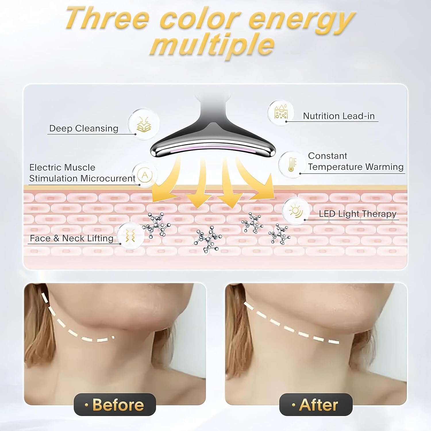 Vegena Electric Face Massager, EMS Anti-Wrinkle Skin Care Device with 3 Modes